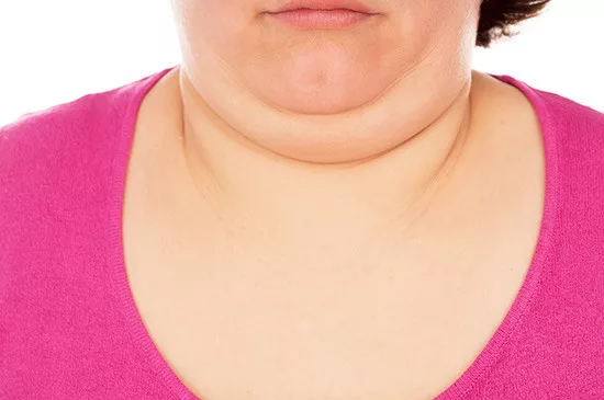 woman with double chin